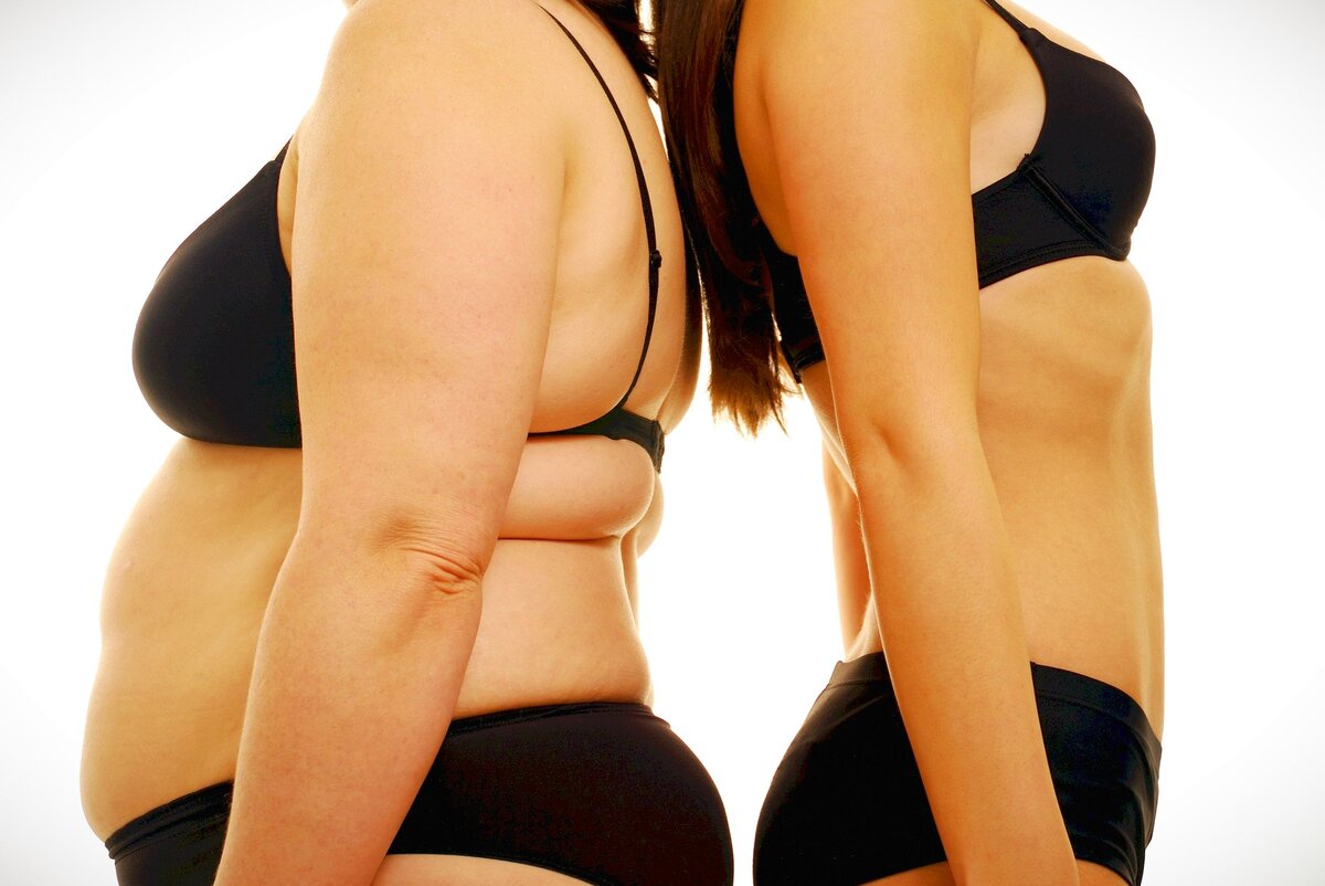 До и после похудения, какая фигура лучше
