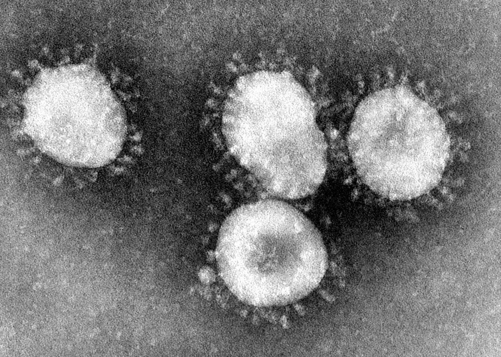 Коронавирусы под электронным микроскопом. Фото - Википедия