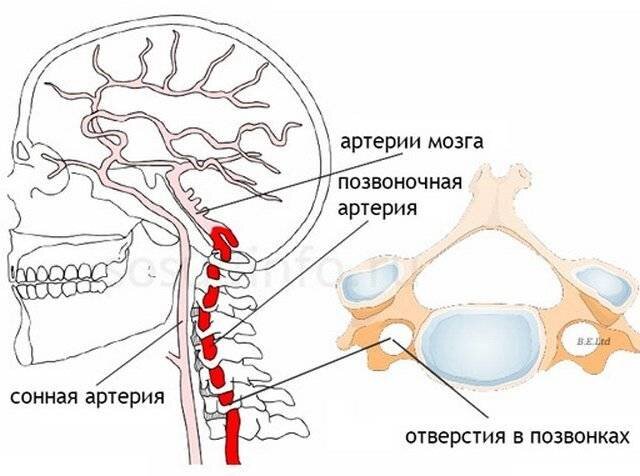 Шейный остеохондроз: признаки, симптомы, лечение патологии