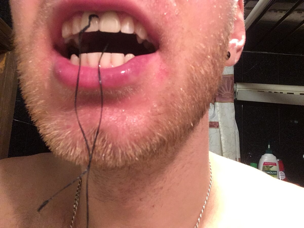 Нитка в зубах