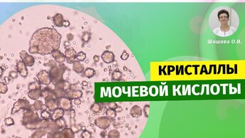 Про кристаллы мочевой кислоты в нашем организме