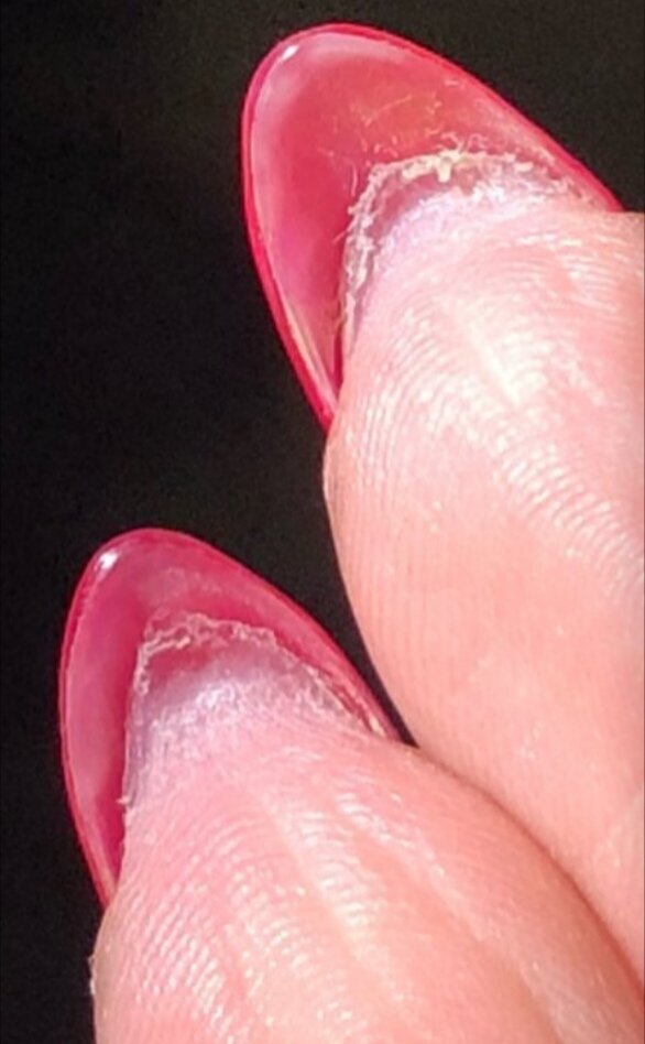 Отросший гипонихий