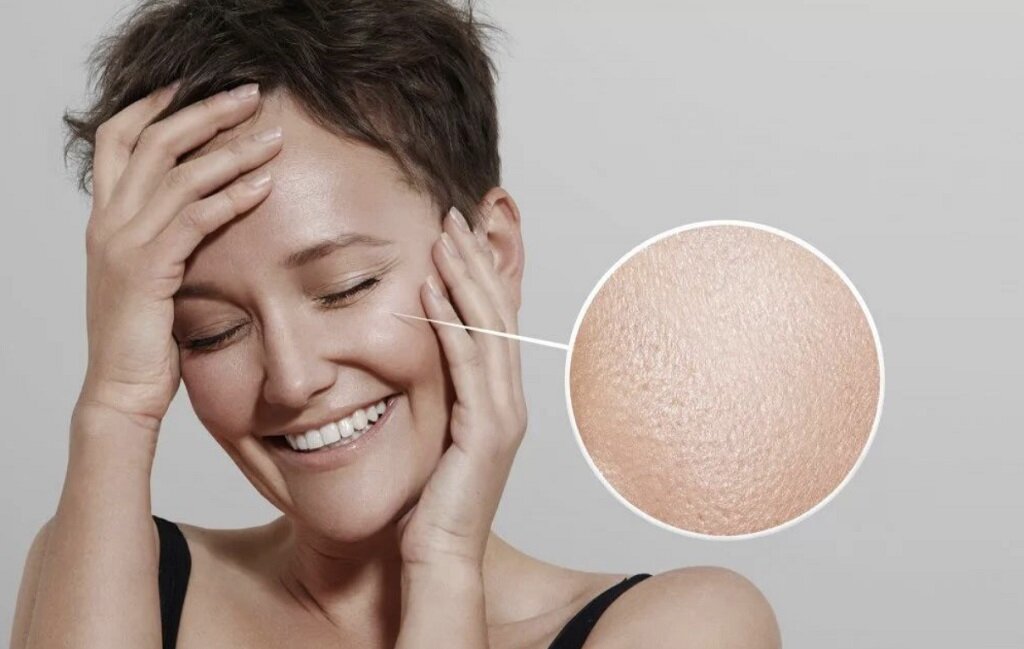 👩Жирная кожа ⠀
✔️кожа плотная, немного грубая на вид
✔️расширены поры ✔️усиленное салоотделение -жирный блеск по всему лицу
✔️жирная кожа склонна к появлению комедонов (черных точек, закупорке пор) и угрей
✔️не склонна к появлению мелких мимических морщин