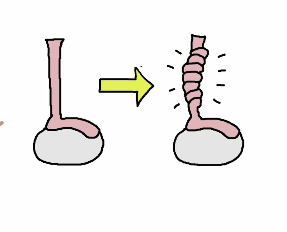 Вот то, что может произойти и это не самое приятное, что может случиться с вами.