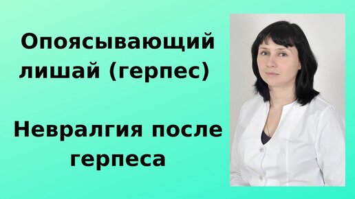 Опоясывающий лишай (герпес). Постгерпетическая невралгия.