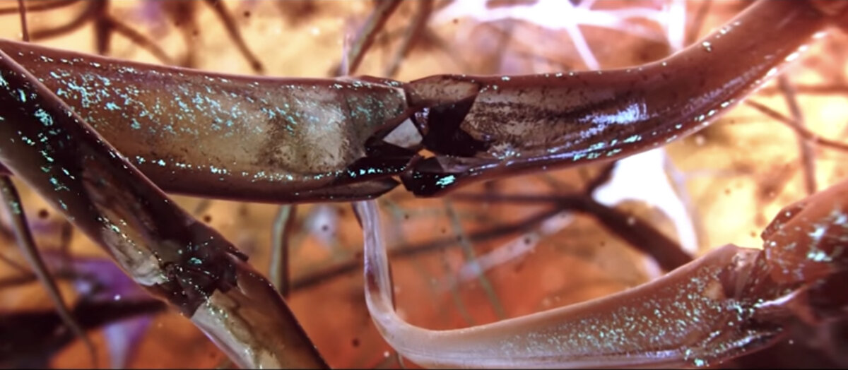 Метастазы. Что это и какие есть методы борьбы?
