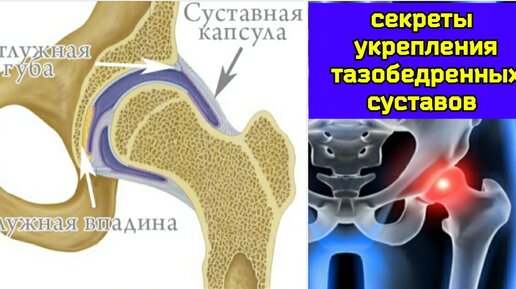 Истощение капсулы тазобедренного сустава не даёт жить ногам и мозгу. Упражнения для восстановления синовиального питания