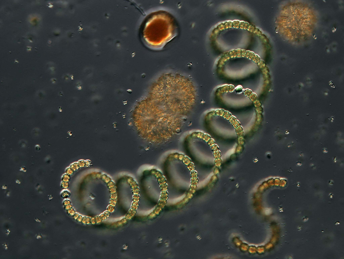 Бактерии в соленой воде. Anabaena spiroides. Анабена спиралевидная. Anabaena planctonica. Многоклеточные цианобактерии.
