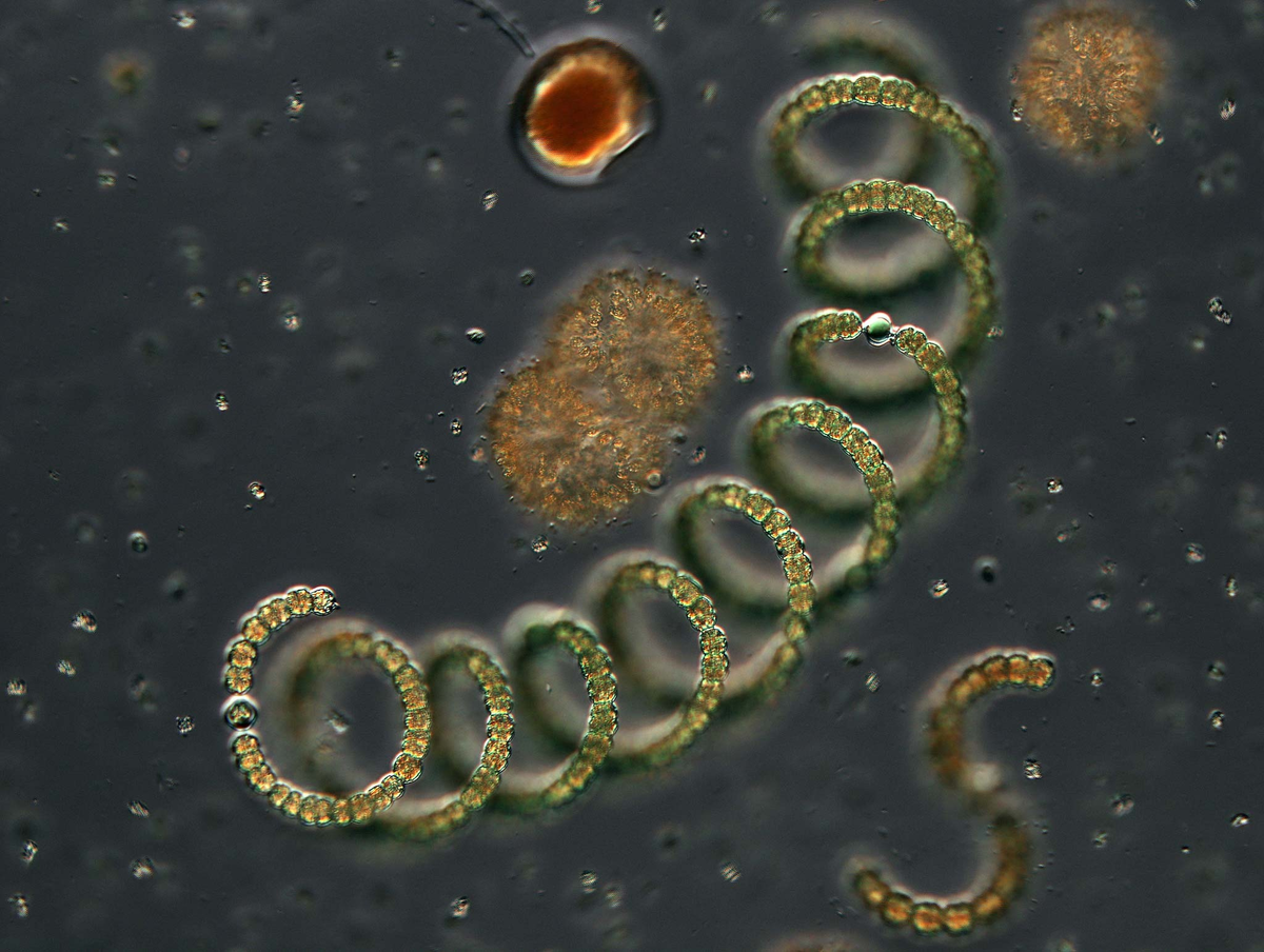 Одноклеточные в воде. Цианобактерия Анабена. Анабена спиралевидная. Anabaena SP. Многоклеточные цианобактерии.