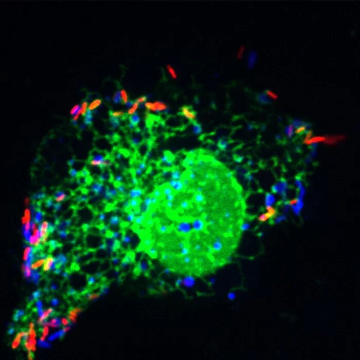 В новом исследовании учёные предположили, что легионелла  (красная) колеблется между эндоплазматическим ретикулумом (зелёный) и  структурами в форме пузырьков или трубок (синий), чтобы создать или  поддержать структуру, в которой находится эта бактерия во время  инфицирования. Визуализация: Тинг-Сун Се, Юго-Западный медицинский центр  Техасского университета