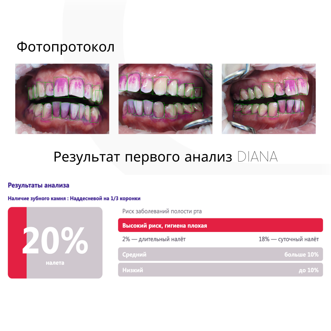 Искусственный интеллект в стоматологии | DIANA | Программа для стоматологов  | Дзен