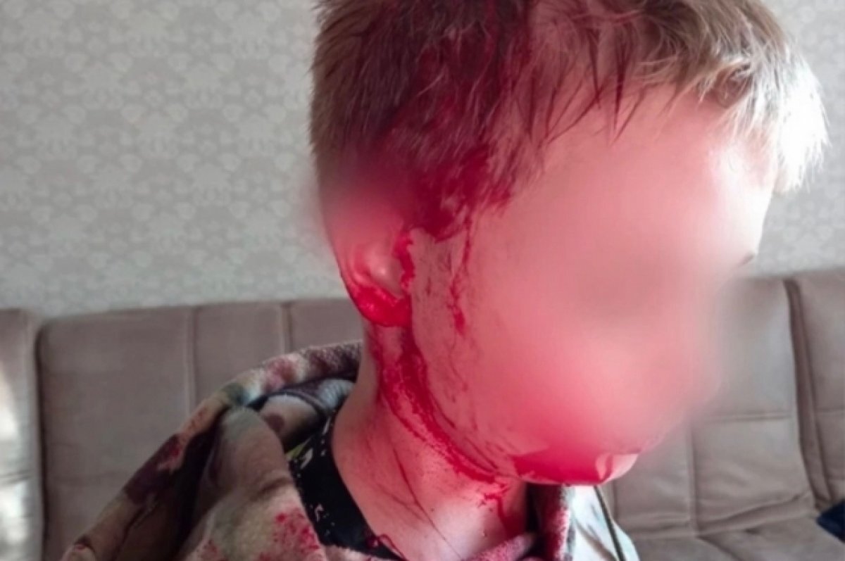    «Бутылкой по голове».