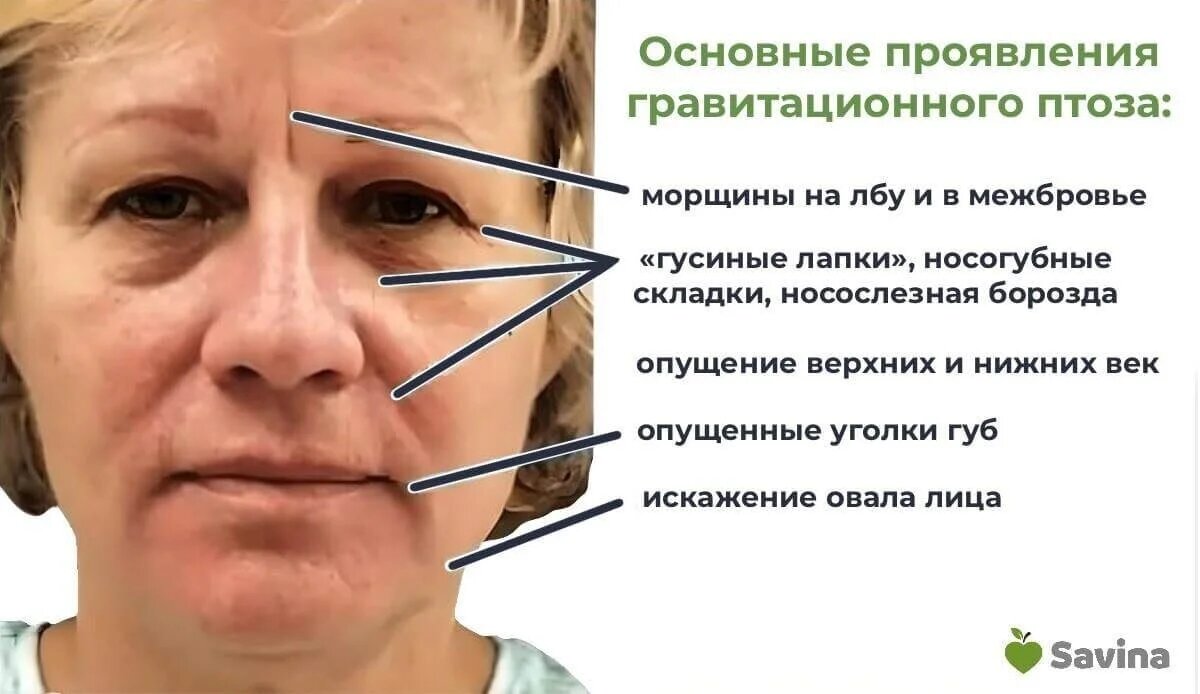 Как понять, что ваш лишний жир не опасен? Признаки ...