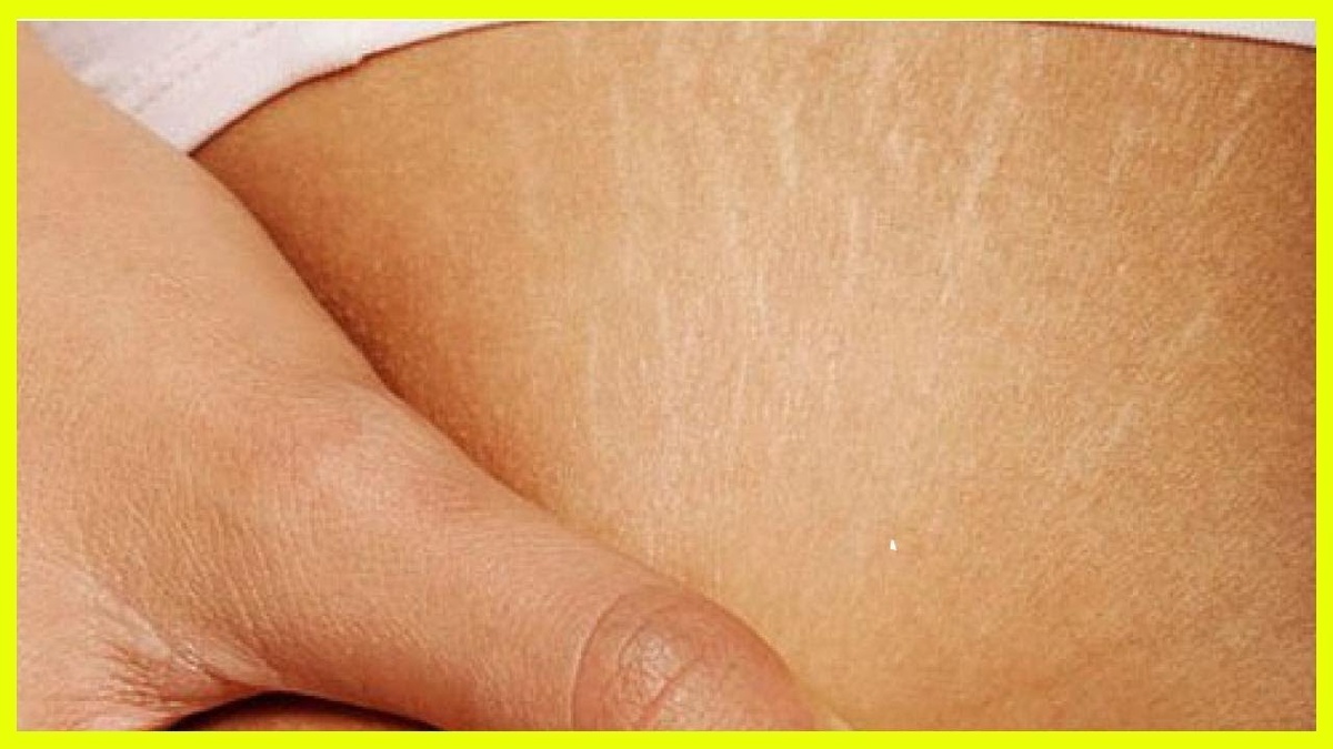 Изображение взято из открытых источников Яндекс. Картинки