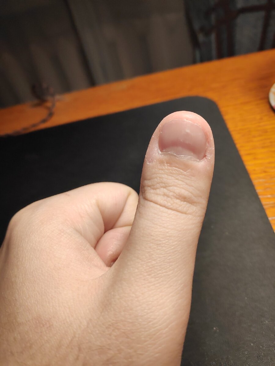 крепышочек