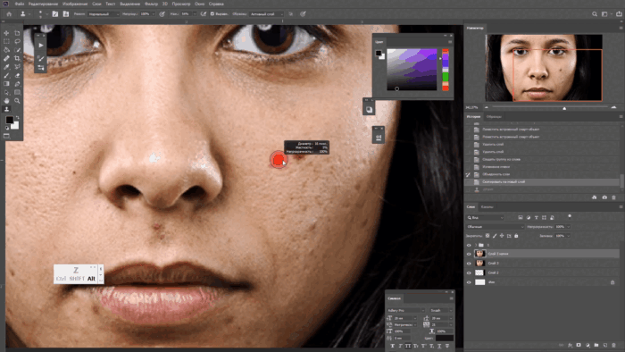 Удаление прыщей через "Штамп"