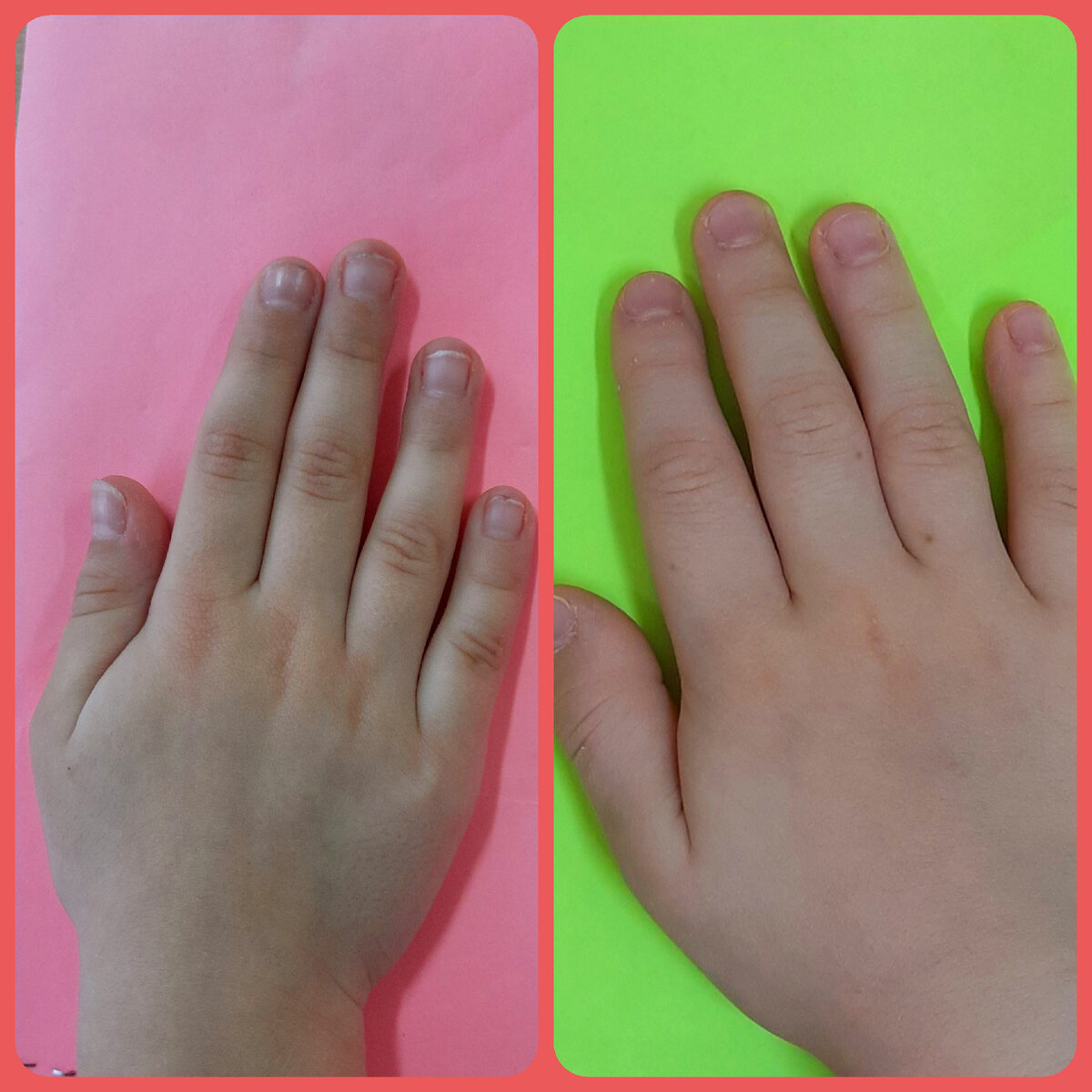 Вам задание: определите, какая ладонь принадлежит мальчику, а какая – девочке. Ответ напитите в комментариях