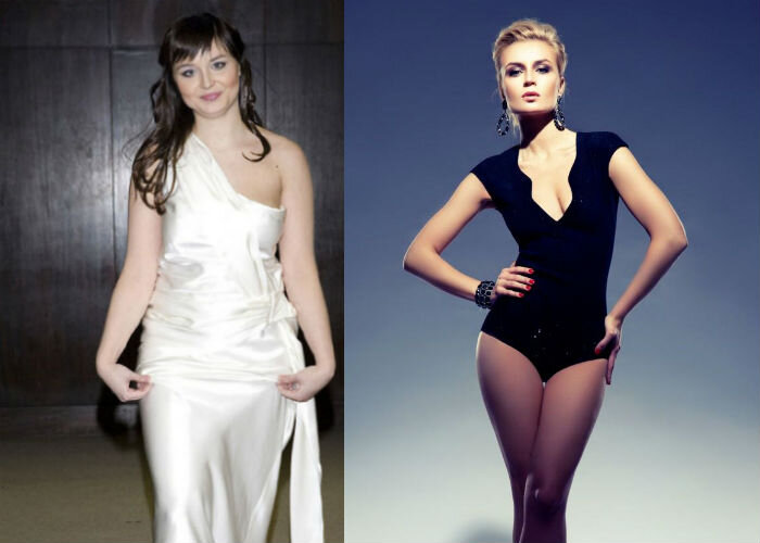 Источник фото: https://umnica-krasavica.ru/polina-gagarina-posle-plastiki/