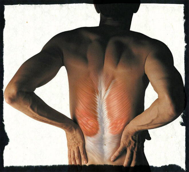 Жар в пояснице. Болят мышцы поясницы. Спазм мышц спины. Спазмированная мышца в спине.