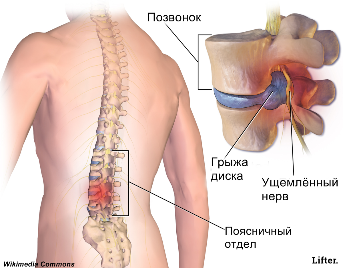 Область поясницы