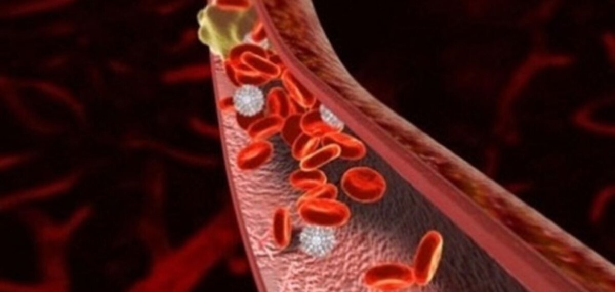 Тромбозы - одни из наиболее опасных состояний в человеческом организме. Фото из открытых источников.
