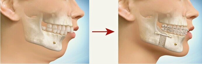 Красота, внешность, лицо, молодость