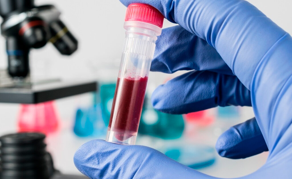 Иммуноонкология