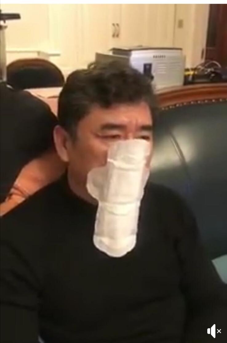 Когда  не хватило маски...