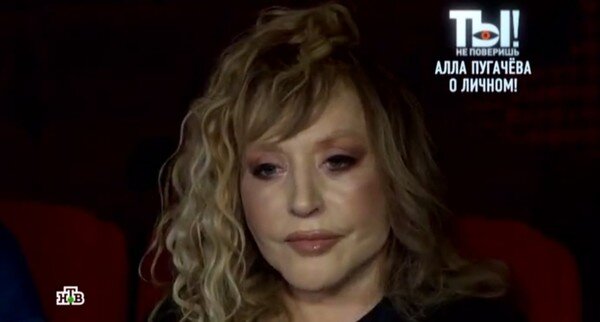 Алла Борисовна сделала подтяжку лица