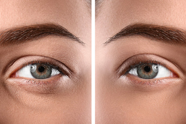 Фото: LEGION-MEDIA