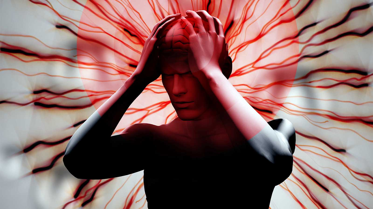 "Гаванский синдром". Фото из интернета.