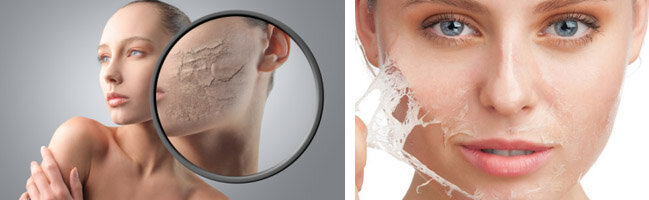 кожа стала жесткой