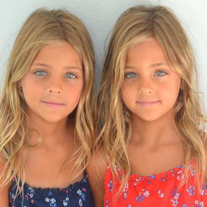 Как восстановилась судьба сестёра, которого в мире называли стойкими красивыми близняшками