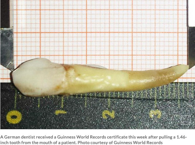 А в сантиметрах он длиннее! или Как немецкий стоматолог поставил рекорд Гиннесса