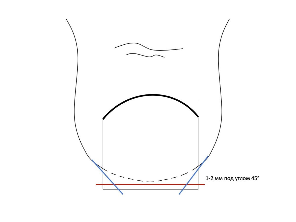 Строение ногтя на ноге большого пальца схема фото