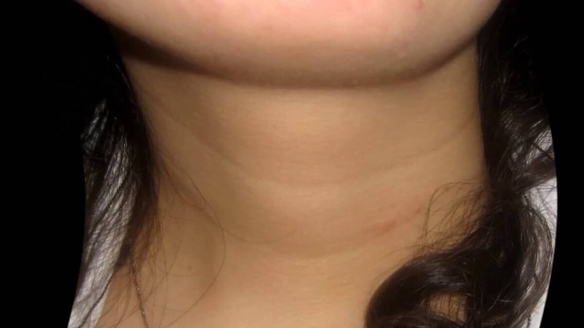 В молодом возрасте! 