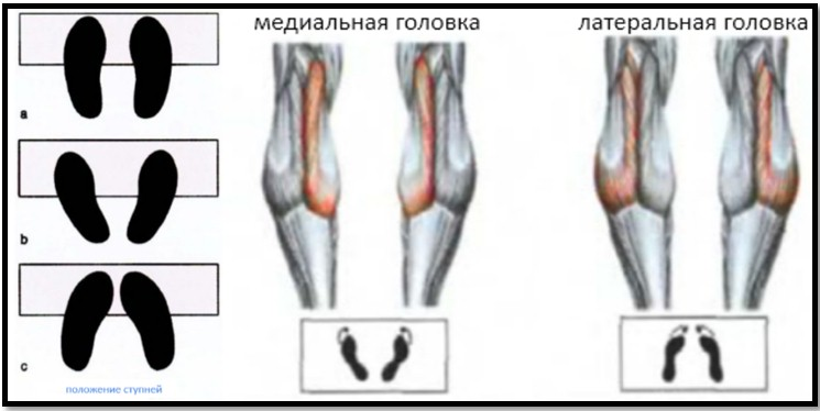 Медиальная и латеральная головка икроножной мышцы. Упражнения для икроножных мышц. Правильная постановка ног. Упражнения на икры постановка ног.
