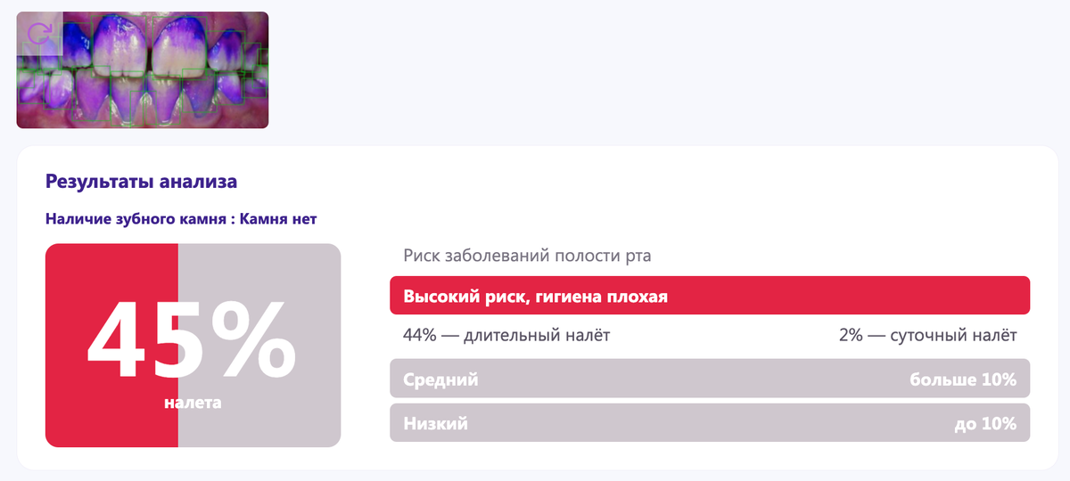 Отчеты программы DIANA
