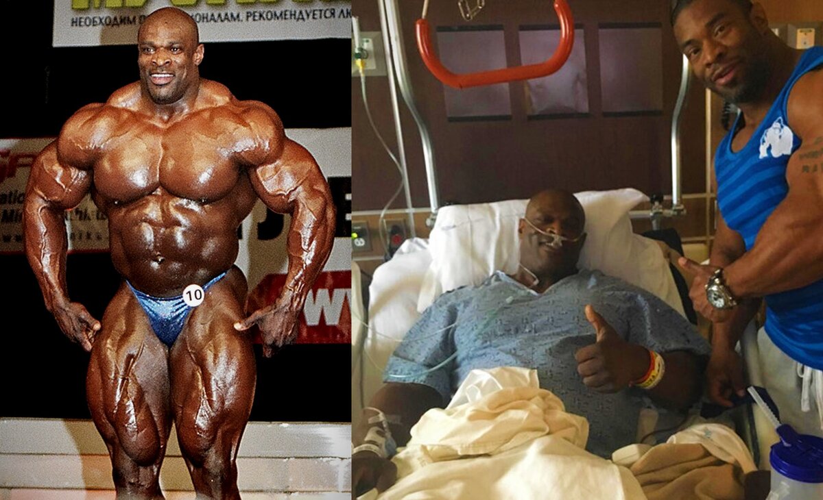 Phil Heat vs Ronnie Coleman vs