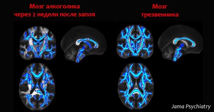 Алкоголизм и психология человека