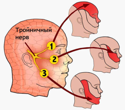 Источник: https://ozubkah.ru 