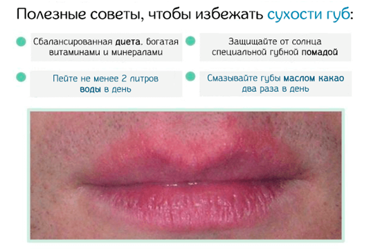 Фотография взята из источникаsekretizdorovya.ru