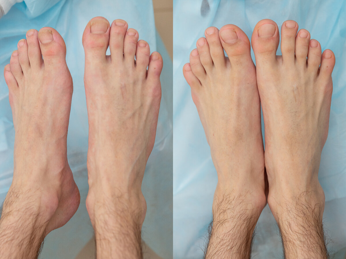 Фото до и после.