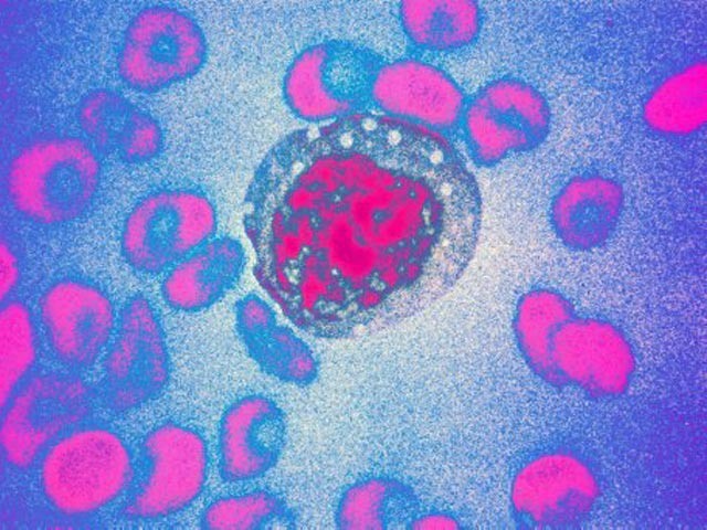 Хантавирус