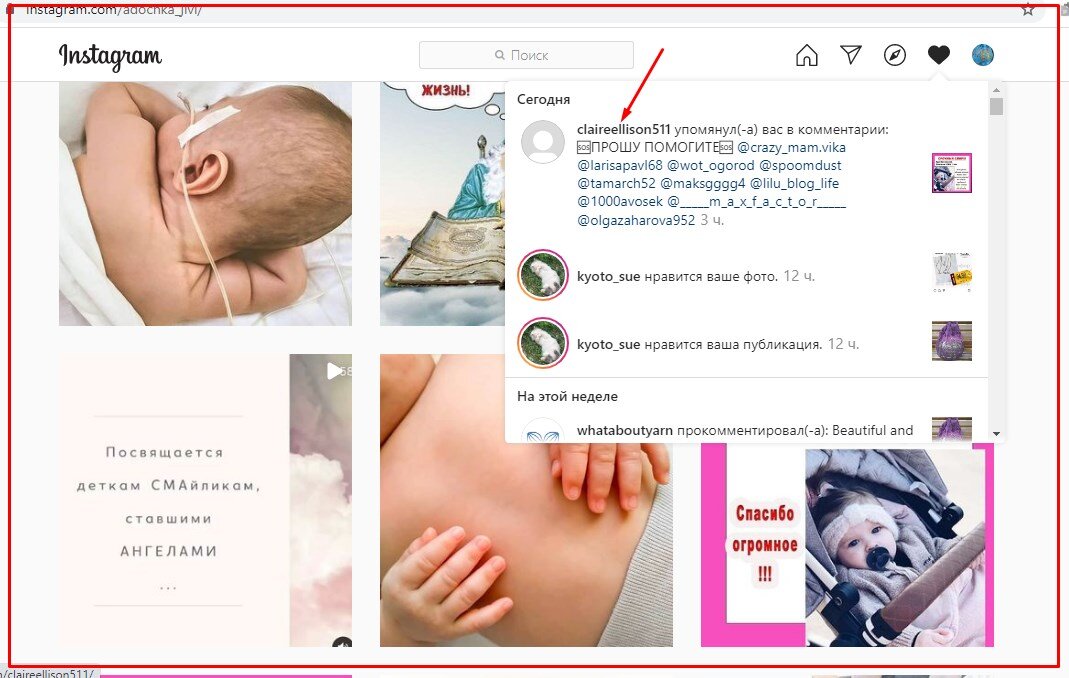 Страница со сбором средств https://www.instagram.com/adochka_jivi/