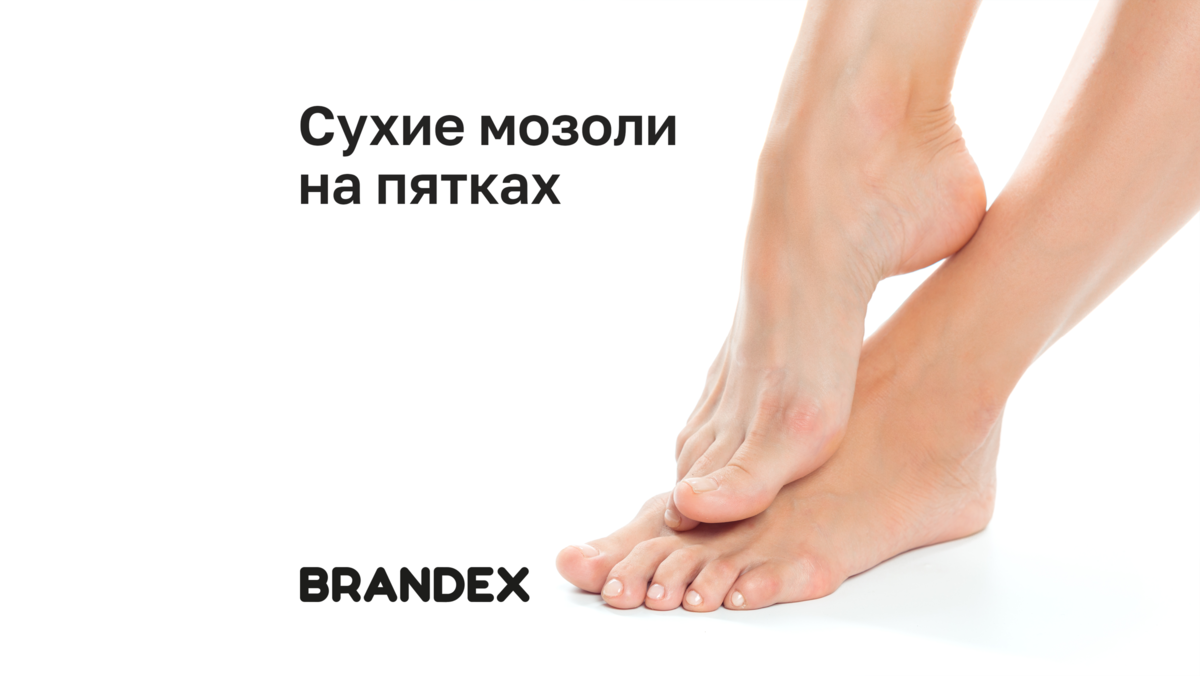 Как убрать сухие мозоли на пятках за 5 минут | BRANDEX CHOICE | Дзен