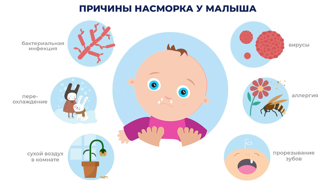 Насморк лечение 2 года. Аллергия у ребенка симптомы. Причины насморка у детей. Физиологический насморк у новорожденных. Насморк у детей симптомы.