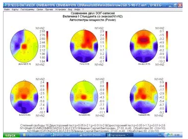 Рис.1.2. Статистически вычисленные изменения спектральной мощности ритмов тех же диапазонов частот. Справа – цветовая шкала коэффициентов достоверности изменений по критерию t-Стьюдента.  Подробности см. в тексте.