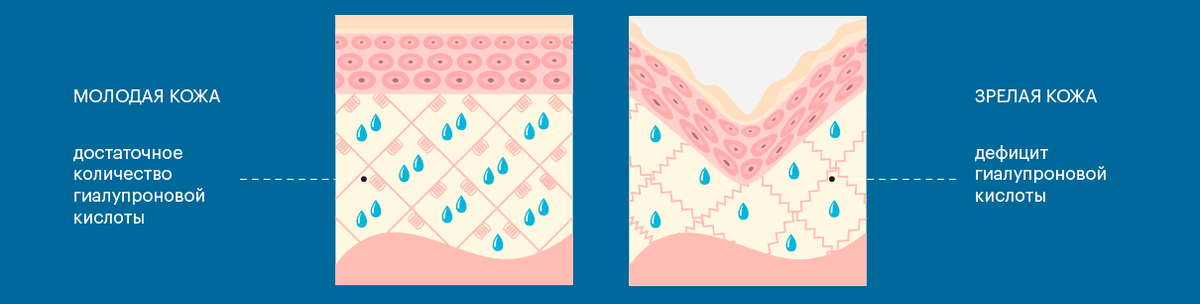 Крем с гиалуроновой кислотой или инъекции. Как выглядит гиалуроновая кислота в чистом виде.