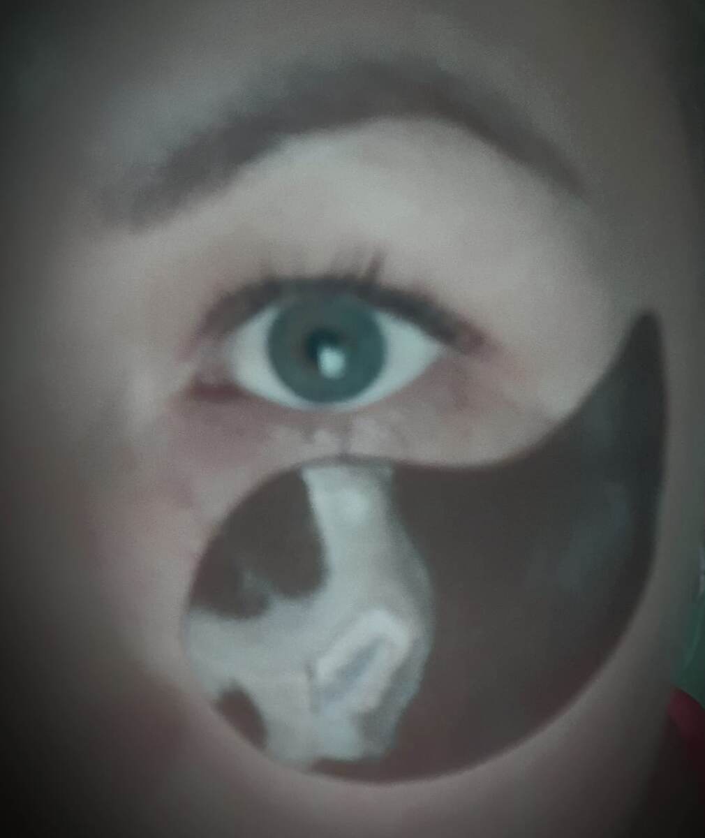 "Чудодейственный" патч((